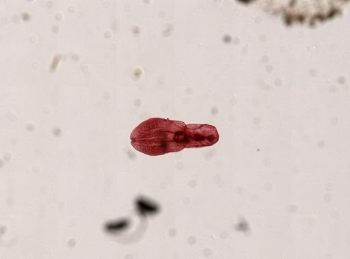 Posthodiplostomum minimum