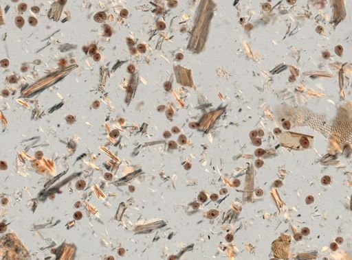 Balantidium coli