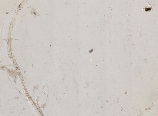 Paramecium