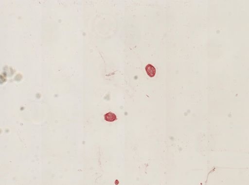 Didinium nasutum