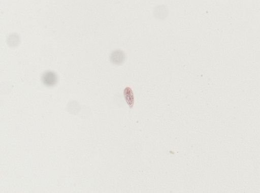 Schistosoma japonicum