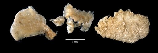 Distoma capsulatum