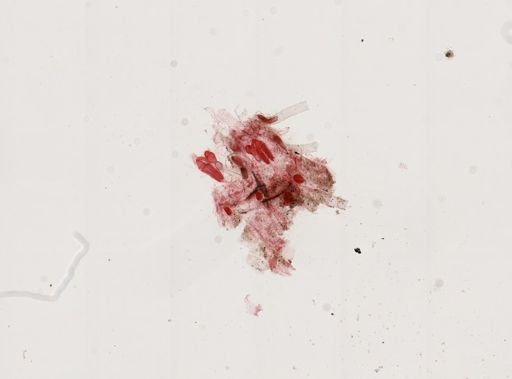 Folliculina