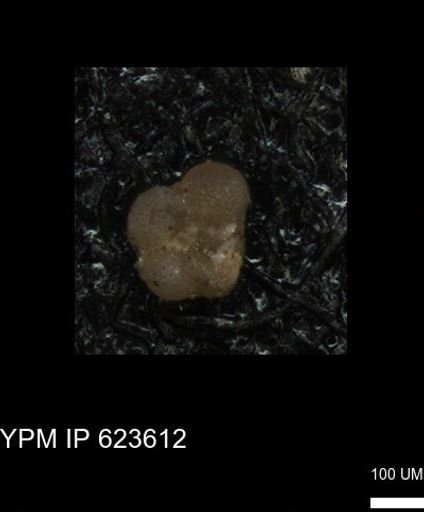 undet. Rugoglobigerinidae
