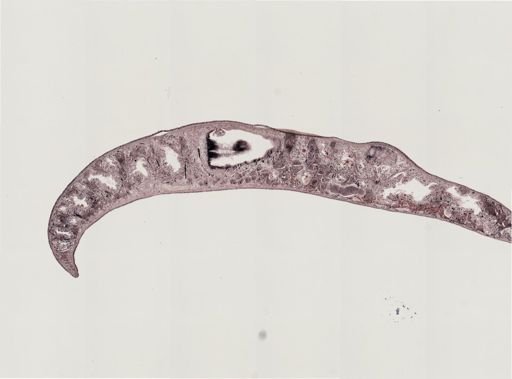 Foviella