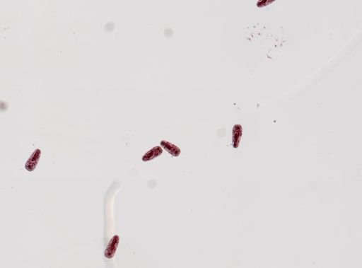 Fasciola hepatica