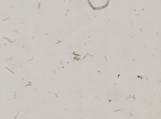 Protosuberites epiphytum