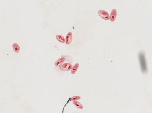 Paramecium