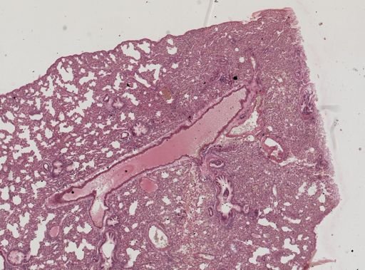 Leishmania donovani