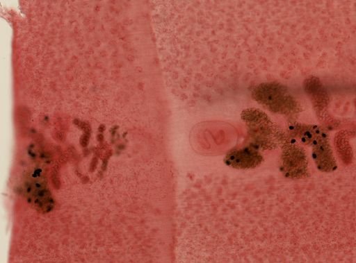 Diphyllobothrium latum