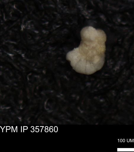 undet. Foraminiferida