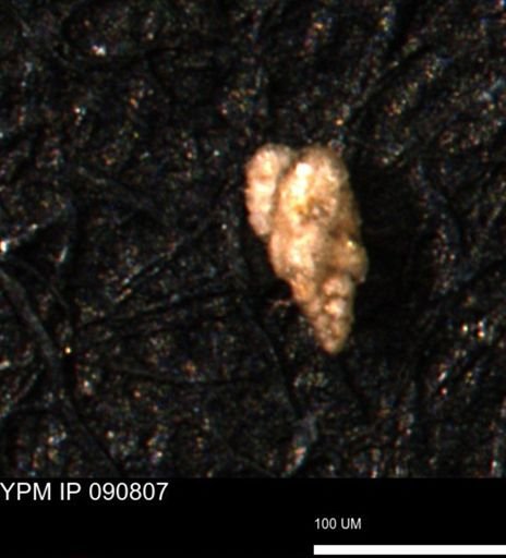 Verneuilina canadensis