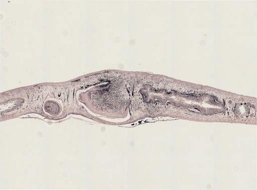 Turbellaria