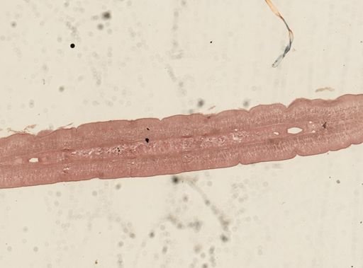 Taenia taeniaeformis