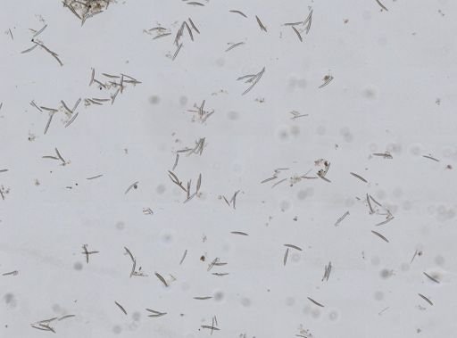 Haliclona