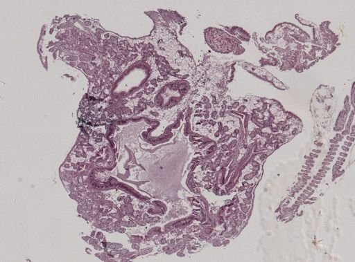 Modiolus