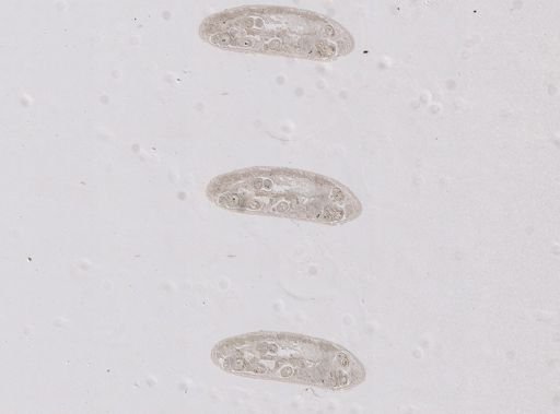Paravortex gemellipara