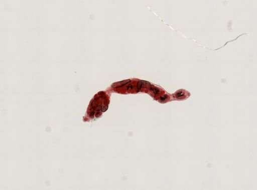 Trematoda