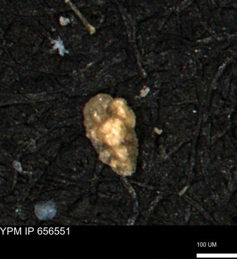 Verneuilina canadensis