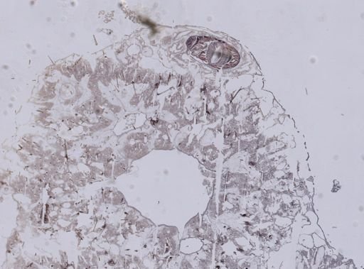Stromatospongia vermicola