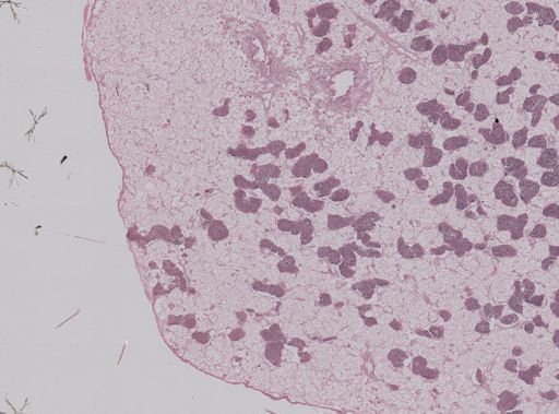 Modiolus