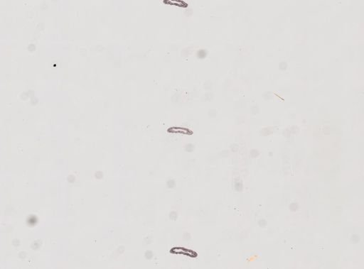 Protohydra leuckarti