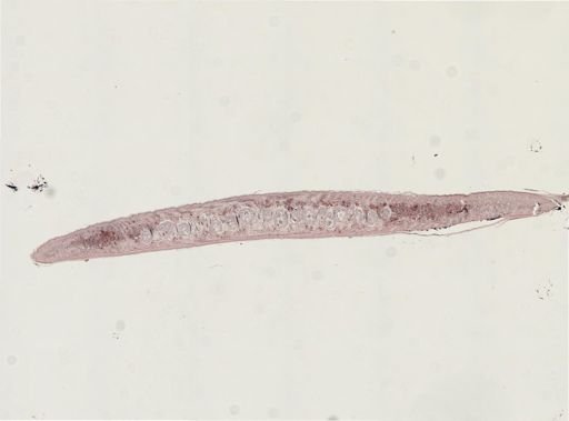 Turbellaria