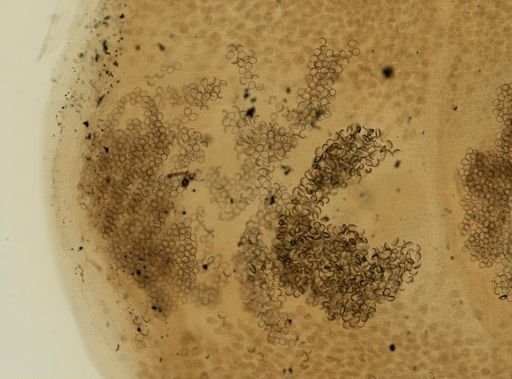 Diphyllobothrium latum