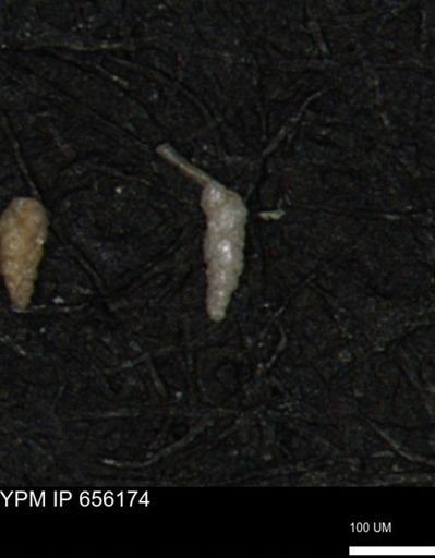 Verneuilina canadensis