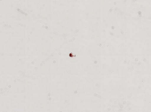 Trematoda