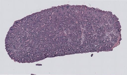 Rana clamitans