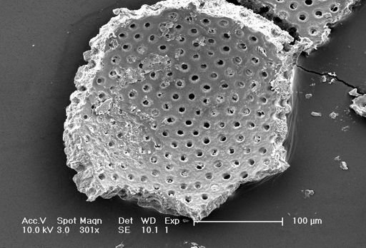 Neogloboquadrina dutertrei