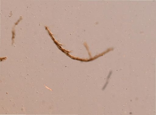 Bryozoa