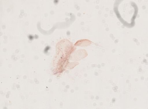Artemia
