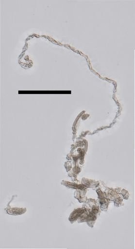 Lensia conoidea