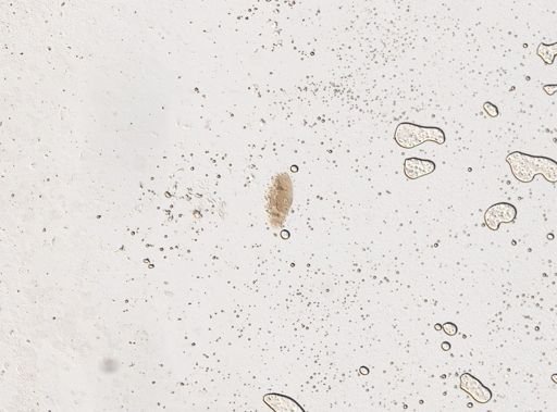 Paramecium multimicronucleatum