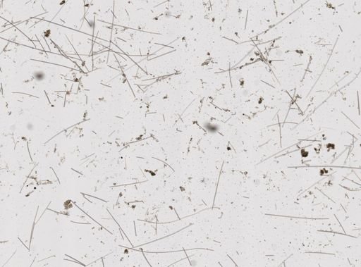 Acanthella acuta