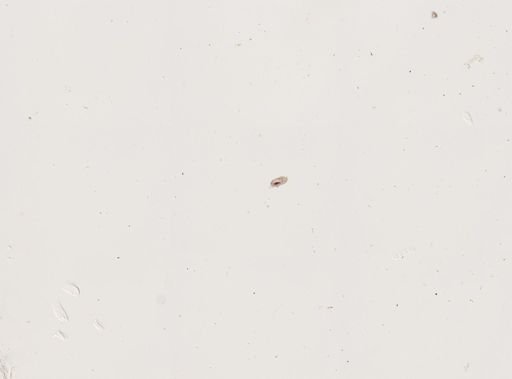 Paramecium trichium