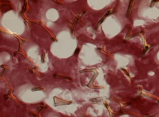 Aplysina cf. cauliformis
