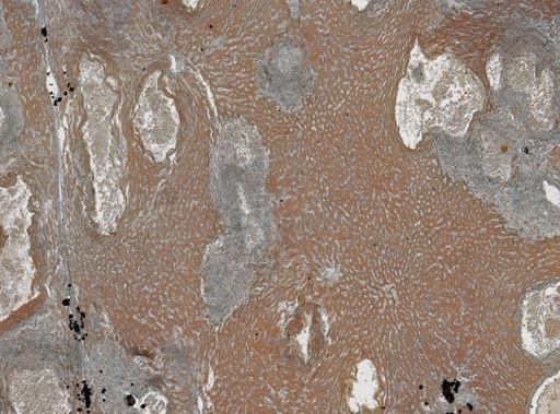 Taenia crassicollis