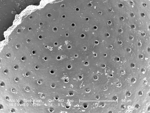 Globigerinoides sacculifer