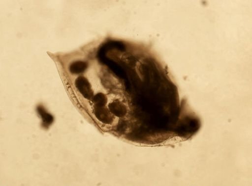 Daphnia pulex