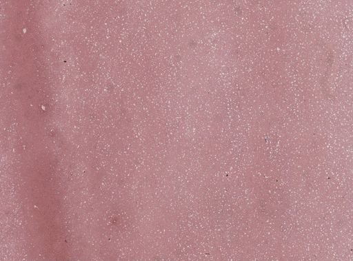 Trypanosoma lewisi