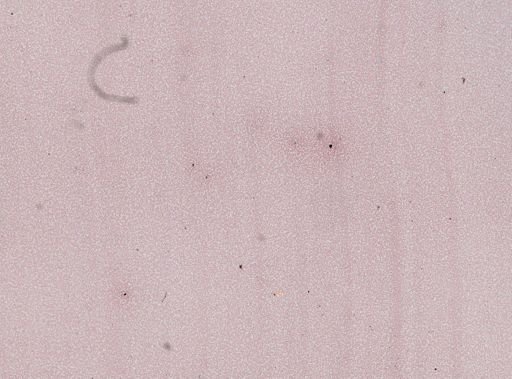 Trypanosoma equinum