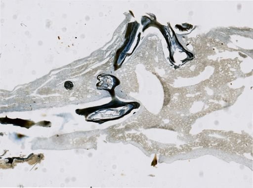 Fasciospongia cavernosa