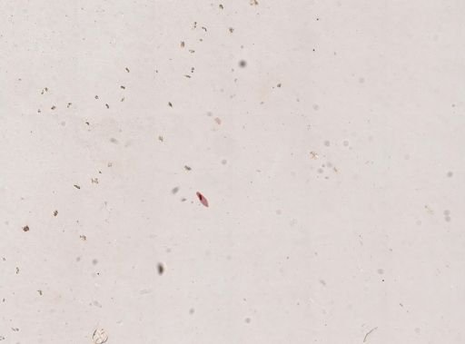Paramecium caudatum