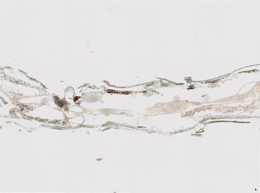 Anoplodactylus lentus