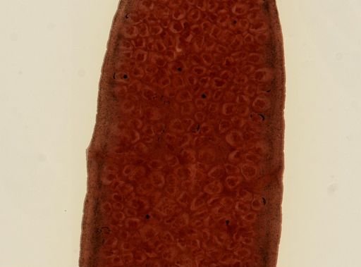 Dipylidium caninum
