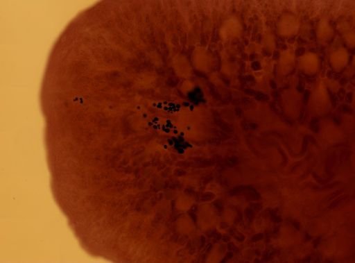 Pleioplana atomata