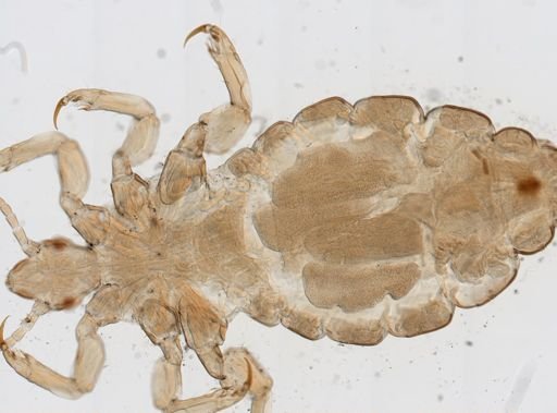 Pediculus humanus